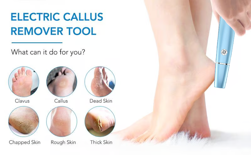 🔥last day sale 50% off🔥Electric callus remover for fee